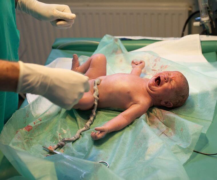 Baby Newborn Screaming w-Doctor