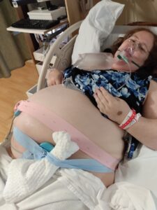 pregnant person having twins laying in hospital bed being monitored and wearing an oxygen mask
