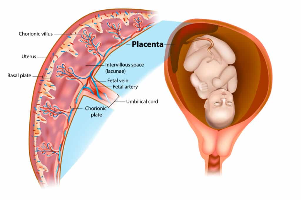 The placent and how it is attached in the uterus